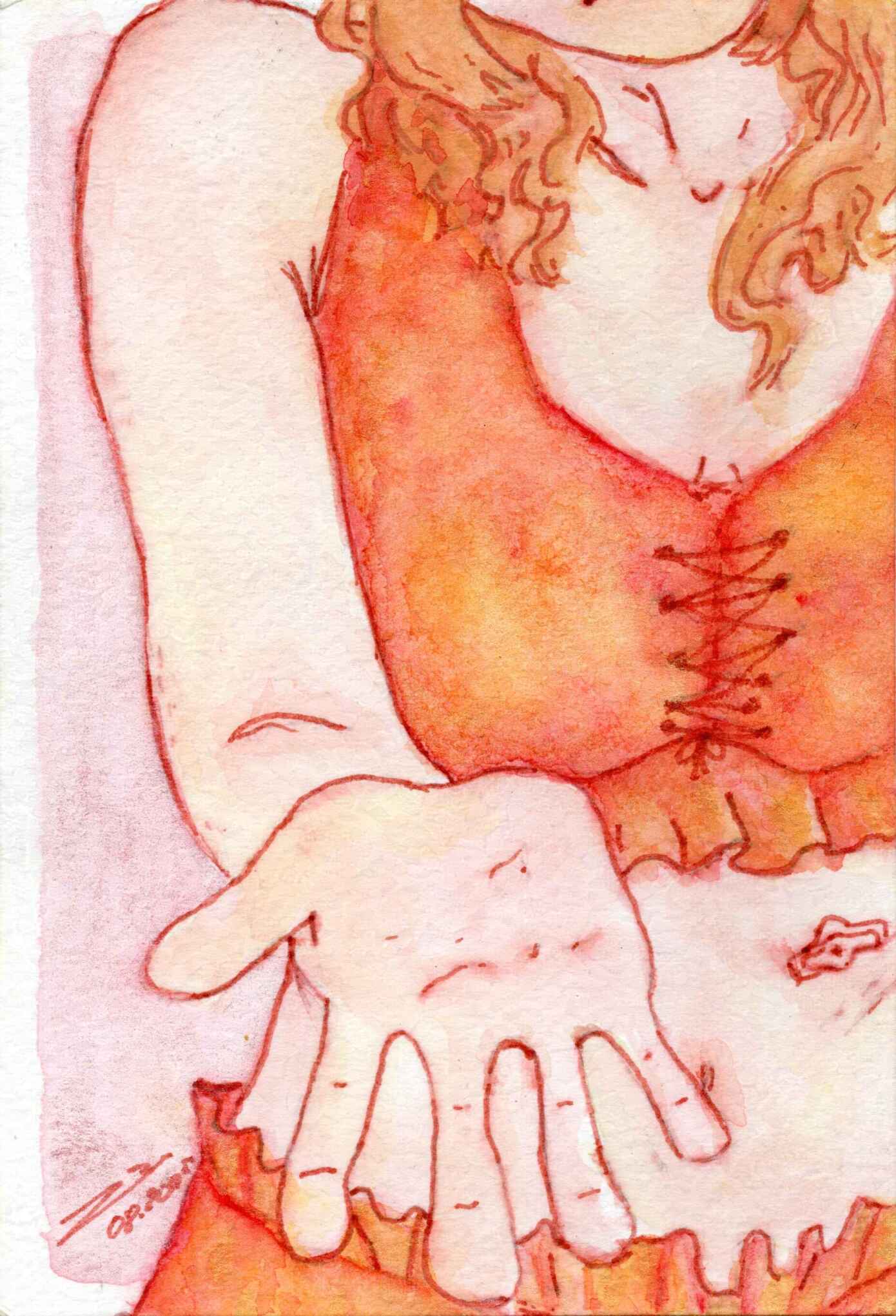 Peinture à l'aquarelle d'une femme qui va de sa taille à son menton. Elle a les cheveux bouclés  qui lui tombent sur les épaules. La femme porte une brassière lacée et un short, tous deux à volants. La femme a un bouton de gastrostomie. Elle tend la main vers le spectateur, comme pour l'inviter.